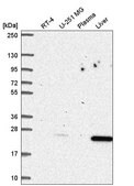 Anti-CDKN1B antibody produced in rabbit Prestige Antibodies&#174; Powered by Atlas Antibodies, affinity isolated antibody