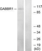 Anti-GABBR1 antibody produced in rabbit affinity isolated antibody