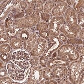 Anti-PDE4D antibody produced in rabbit Prestige Antibodies&#174; Powered by Atlas Antibodies, affinity isolated antibody, buffered aqueous glycerol solution