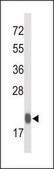ANTI-GPX1 (C-TERM) antibody produced in rabbit IgG fraction of antiserum, buffered aqueous solution