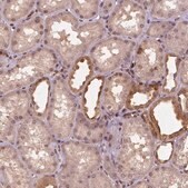 Anti-STAT3 antibody produced in rabbit Prestige Antibodies&#174; Powered by Atlas Antibodies, affinity isolated antibody, buffered aqueous glycerol solution