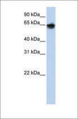 Anti-KRT1 antibody produced in rabbit affinity isolated antibody