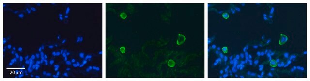 Anti-CA4 (AB1) antibody produced in rabbit affinity isolated antibody