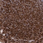 Anti-SYK antibody produced in rabbit Prestige Antibodies&#174; Powered by Atlas Antibodies, affinity isolated antibody, buffered aqueous glycerol solution