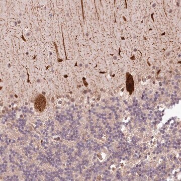 Anti-ALKBH8 antibody produced in rabbit Prestige Antibodies&#174; Powered by Atlas Antibodies, affinity isolated antibody, buffered aqueous glycerol solution
