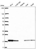 Anti-Cfl1 Antibody Produced In Rabbit Prestige Antibodies&#174; Powered by Atlas Antibodies, affinity isolated antibody, buffered aqueous glycerol solution