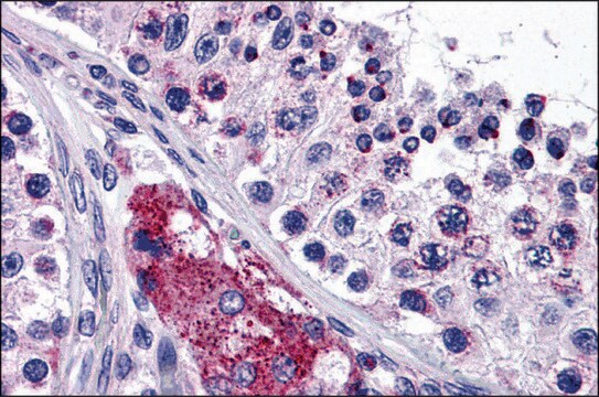 Anti-PTCHD2 antibody produced in rabbit affinity isolated antibody