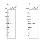 Anti-GPI antibody produced in rabbit Prestige Antibodies&#174; Powered by Atlas Antibodies, affinity isolated antibody, buffered aqueous glycerol solution
