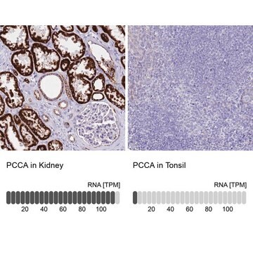 Anti-PCCA antibody produced in rabbit Prestige Antibodies&#174; Powered by Atlas Antibodies, affinity isolated antibody, buffered aqueous glycerol solution