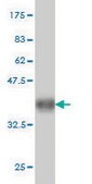 ANTI-KIT antibody produced in mouse clone 3A8, purified immunoglobulin, buffered aqueous solution