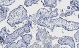 Anti-Transglutaminase 2 Antibody, clone 1G20 ZooMAb&#174; Rabbit recombinant, expressed in HEK 293 cells