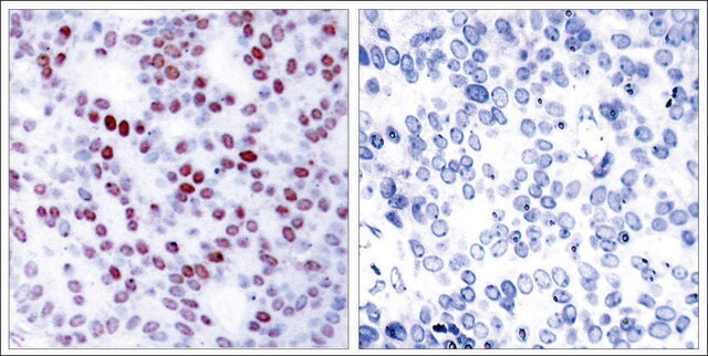 Anti-JUN (Ab-243) antibody produced in rabbit affinity isolated antibody
