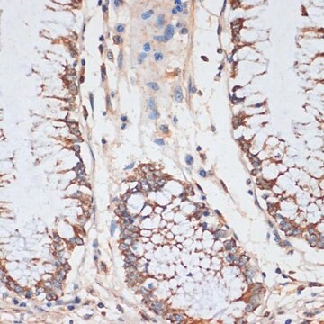 Anti-CDK4 antibody produced in rabbit