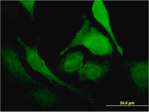 Monoclonal Anti-PUS1 antibody produced in mouse clone 3A3, purified immunoglobulin, buffered aqueous solution