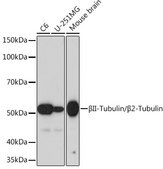 Anti-&#946;II-Tubulin/&#946;2-Tubulin Antibody, clone 1R3R9, Rabbit Monoclonal