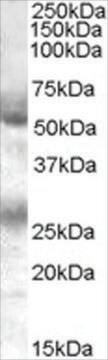 Anti-FLVCR antibody produced in goat affinity isolated antibody, buffered aqueous solution