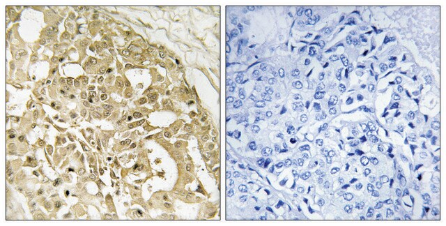 Anti-Catenin-&#946; antibody produced in rabbit affinity isolated antibody