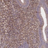 Anti-SFRP4 antibody produced in rabbit Prestige Antibodies&#174; Powered by Atlas Antibodies, affinity isolated antibody, buffered aqueous glycerol solution