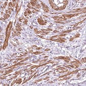 Anti-DPP3 antibody produced in rabbit Prestige Antibodies&#174; Powered by Atlas Antibodies, affinity isolated antibody, buffered aqueous glycerol solution