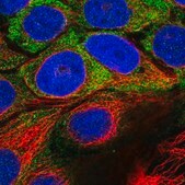 Anti-USH1C antibody produced in rabbit Prestige Antibodies&#174; Powered by Atlas Antibodies, affinity isolated antibody, buffered aqueous glycerol solution, ab1