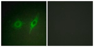 Anti-Collagen IV &#945;2 antibody produced in rabbit affinity isolated antibody