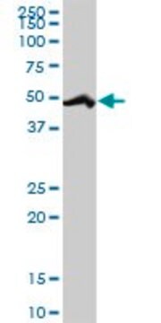 Anti-RBM39 antibody produced in rabbit purified immunoglobulin, buffered aqueous solution