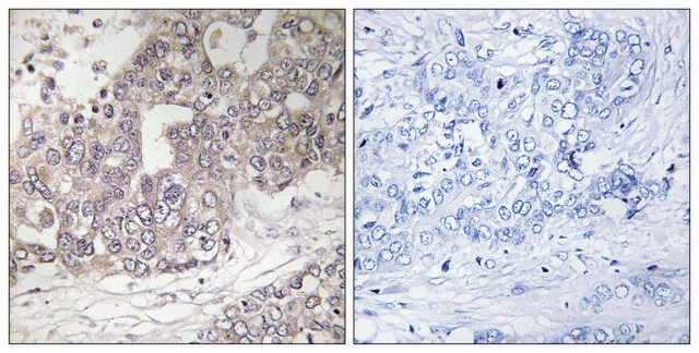 Anti-ATG4C antibody produced in rabbit affinity isolated antibody
