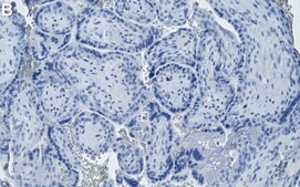 Anti-Laminin-5 Antibody, clone 1D3 ZooMAb&#174; Rabbit Monoclonal recombinant, expressed in HEK 293 cells