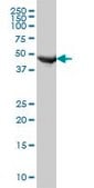Monoclonal Anti-FH, (C-terminal) antibody produced in mouse clone 3E7, purified immunoglobulin, buffered aqueous solution
