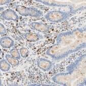 Anti-CD63 antibody produced in rabbit affinity isolated antibody, Prestige Antibodies&#174; Powered by Atlas Antibodies, buffered aqueous glycerol solution