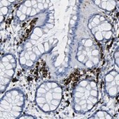 Anti-PLD3 antibody produced in rabbit Prestige Antibodies&#174; Powered by Atlas Antibodies, affinity isolated antibody, buffered aqueous glycerol solution
