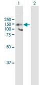 Anti-HDAC9 antibody produced in mouse purified immunoglobulin, buffered aqueous solution