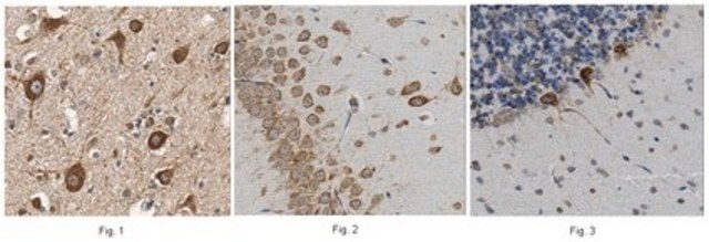 Anti-NDUFS3 Antibody, clone 6H7.1 clone 6H7.1, from mouse