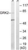 Anti-GRK2 antibody produced in rabbit affinity isolated antibody
