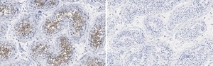 Anti-PPP3CC Antibody, clone 2C2 ZooMAb&#174; Rabbit Monoclonal recombinant, expressed in HEK 293 cells