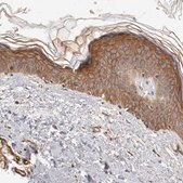 Anti-TYK2 antibody produced in rabbit Prestige Antibodies&#174; Powered by Atlas Antibodies, affinity isolated antibody, buffered aqueous glycerol solution