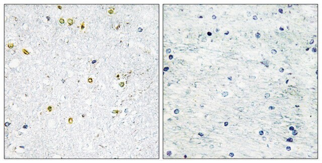 Anti-TRIM24 antibody produced in rabbit affinity isolated antibody