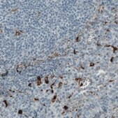 Monoclonal Anti-MMP9 antibody produced in mouse Prestige Antibodies&#174; Powered by Atlas Antibodies, clone CL0539, purified immunoglobulin, buffered aqueous glycerol solution