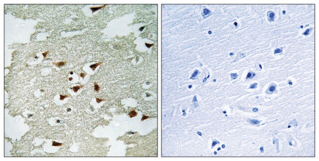 Anti-AKT antibody produced in rabbit affinity isolated antibody