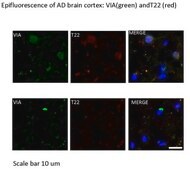Anti-A&#946;-42 Antibody, oligomeric (VIA) serum, from rabbit
