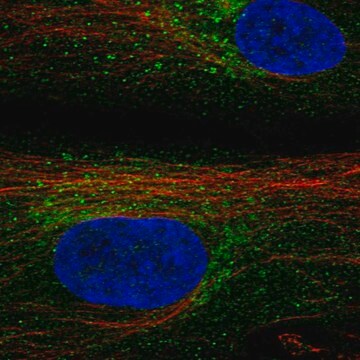 Anti-Timp3 Antibody Produced In Rabbit Prestige Antibodies&#174; Powered by Atlas Antibodies, affinity isolated antibody, buffered aqueous glycerol solution