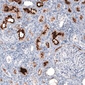 Monoclonal Anti-ACE2 antibody produced in mouse Prestige Antibodies&#174; Powered by Atlas Antibodies, clone CL4035, purified immunoglobulin