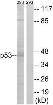 Anti-p53 antibody produced in rabbit affinity isolated antibody