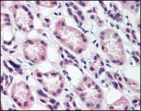 Anti-RREB1 antibody produced in rabbit IgG fraction of antiserum, buffered aqueous solution