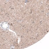 Anti-HTR1E antibody produced in rabbit Prestige Antibodies&#174; Powered by Atlas Antibodies, affinity isolated antibody, buffered aqueous glycerol solution