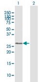 Anti-GSTO1 antibody produced in mouse purified immunoglobulin, buffered aqueous solution