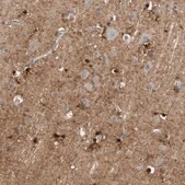 Anti-GLUL antibody produced in rabbit Ab2, Prestige Antibodies&#174; Powered by Atlas Antibodies, affinity isolated antibody, buffered aqueous glycerol solution