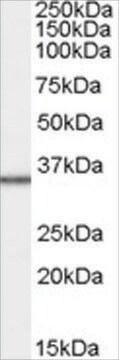 Anti-MRPL3 antibody produced in goat affinity isolated antibody, buffered aqueous solution