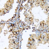 Anti-Cortactin antibody produced in rabbit