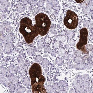 Anti-Klk1 Antibody Produced In Rabbit Prestige Antibodies&#174; Powered by Atlas Antibodies, affinity isolated antibody, buffered aqueous glycerol solution